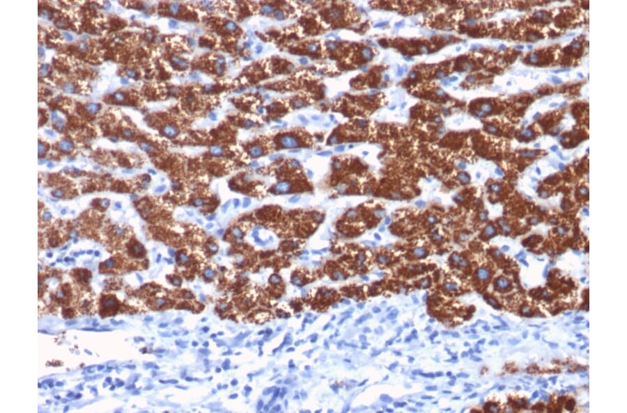 Immunohistochemistry - Anti-Hepatocyte Specific Antigen Antibody [OCH1E5] (A250886) - Antibodies.com