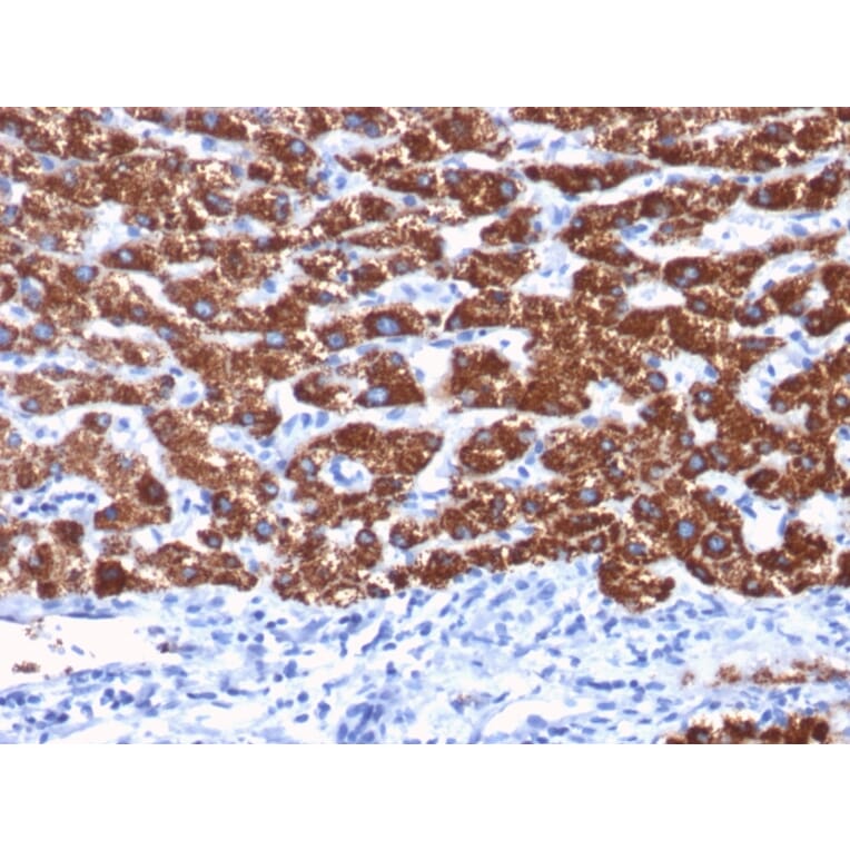 Immunohistochemistry - Anti-Hepatocyte Specific Antigen Antibody [OCH1E5] (A250886) - Antibodies.com