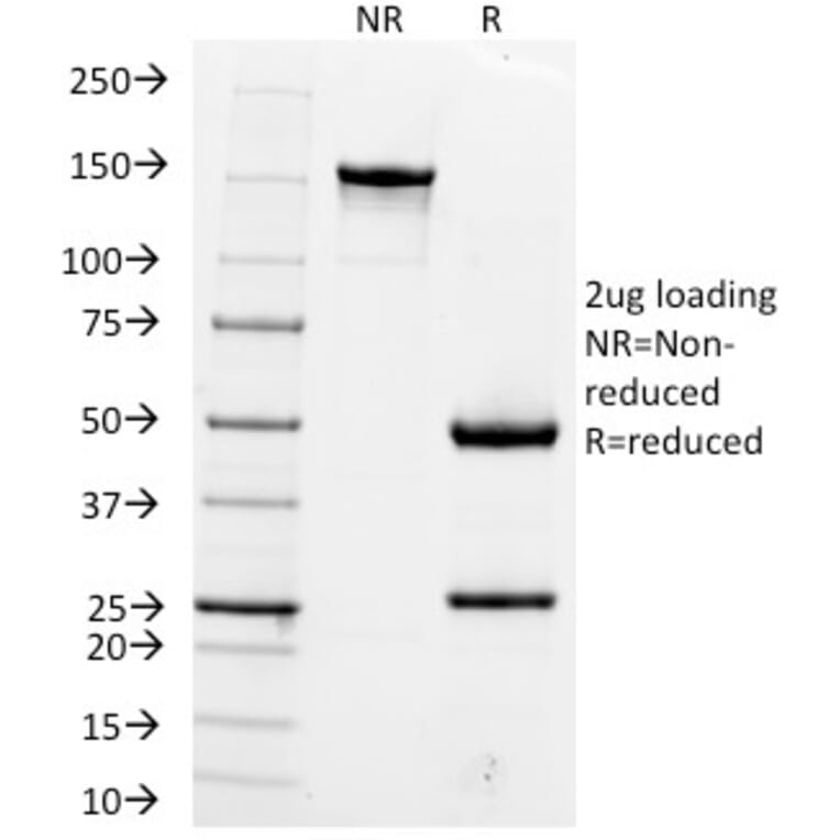SDS-PAGE - Anti-Hepatocyte Specific Antigen Antibody [OCH1E5] (A250888) - Antibodies.com