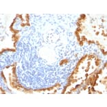 Immunohistochemistry - Anti-Cytokeratin 8 + 18 Antibody [KRT8/803 + KRT18/835] (A250889) - Antibodies.com
