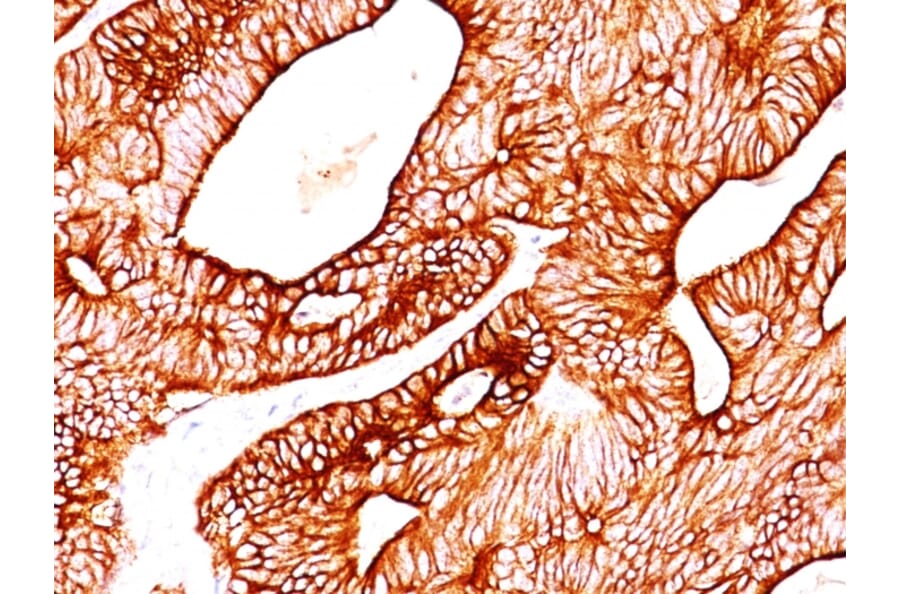 Immunohistochemistry - Anti-Cytokeratin 8 + 18 Antibody [KRT8/803 + KRT18/835] (A250888) - Antibodies.com