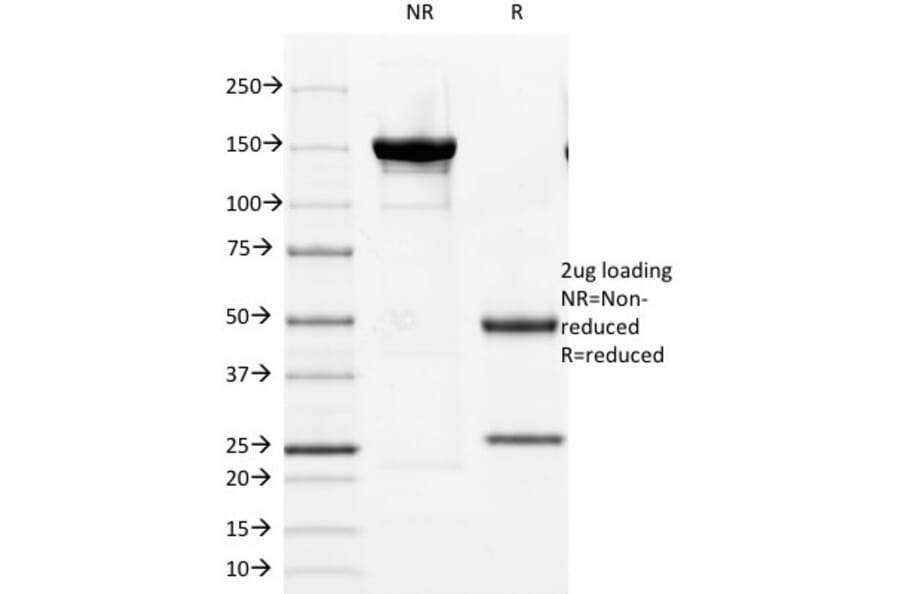 SDS-PAGE - Anti-Cytokeratin 8 + 18 Antibody [KRT8/803 + KRT18/835] (A250889) - Antibodies.com