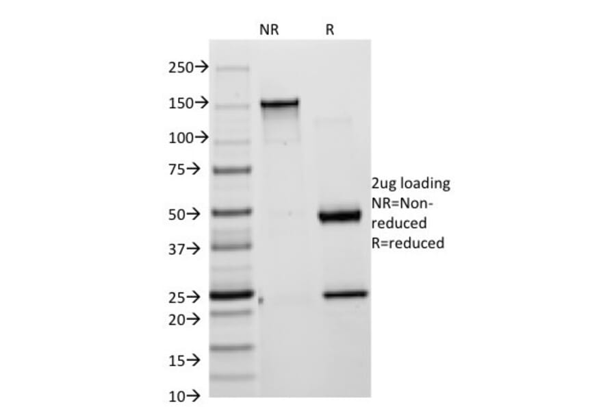 SDS-PAGE - Anti-Cytokeratin 8 + 18 Antibody [KRT8/803 + KRT18/835] (A250889) - Antibodies.com