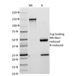 SDS-PAGE - Anti-Cytokeratin 8 + 18 Antibody [KRT8/803 + KRT18/835] (A250889) - Antibodies.com