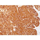 Immunohistochemistry - Anti-Melanoma Marker (MART-1 + Tyrosinase + gp100) Antibody [M2-7C10 + M2-9E3 + T311 + HMB45] (A250889) - Antibodies.com