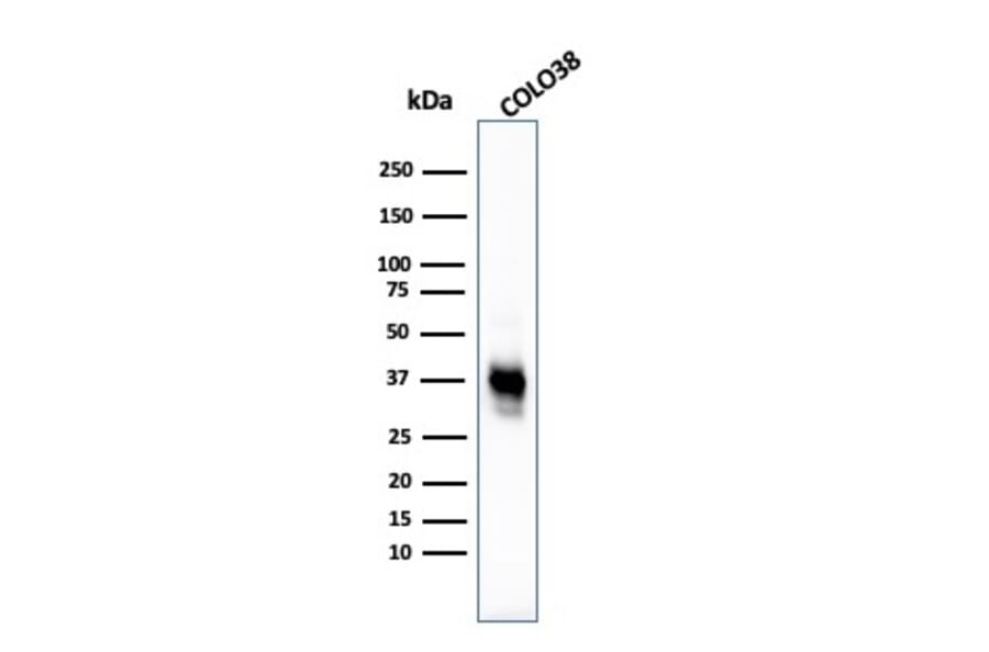 Western Blot - Anti-Melanoma Marker (MART-1 + Tyrosinase + gp100) Antibody [M2-7C10 + M2-9E3 + T311 + HMB45] (A250890) - Antibodies.com
