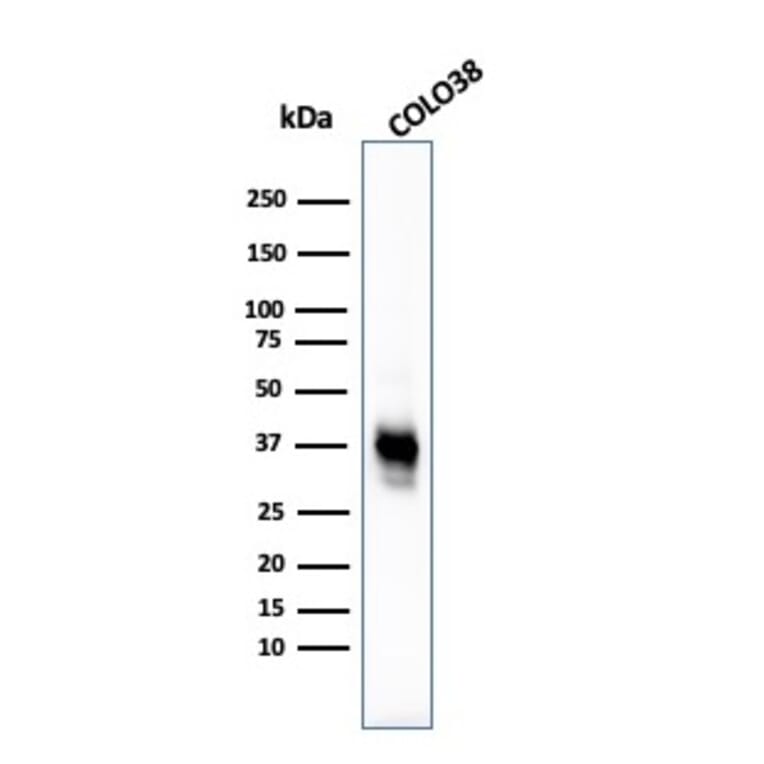 Western Blot - Anti-Melanoma Marker (MART-1 + Tyrosinase + gp100) Antibody [M2-7C10 + M2-9E3 + T311 + HMB45] (A250890) - Antibodies.com
