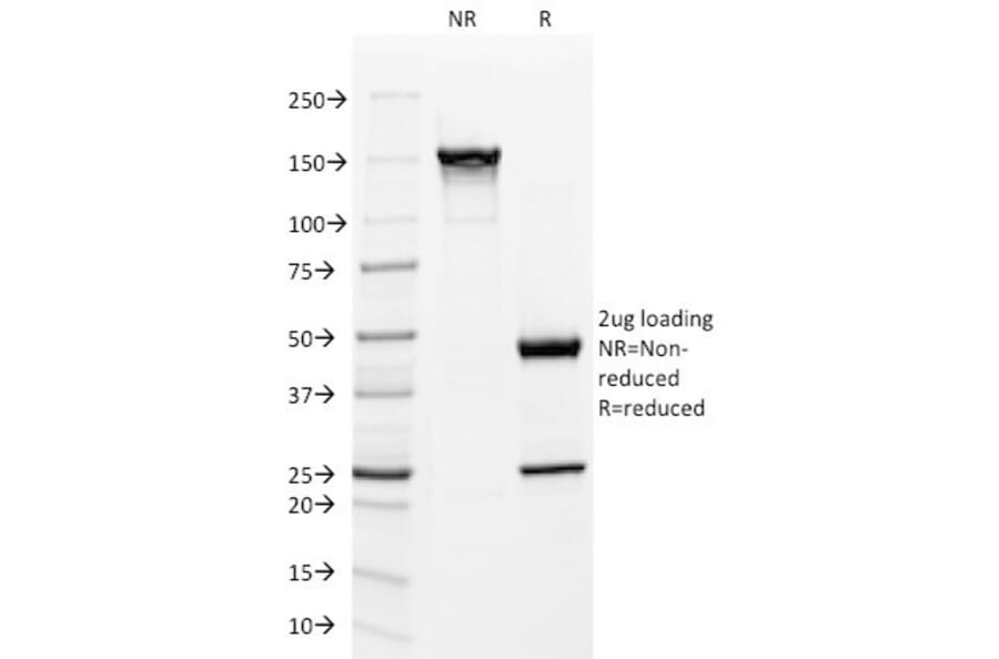 SDS-PAGE - Anti-Mitochondria Antibody [113-1] (A250891) - Antibodies.com