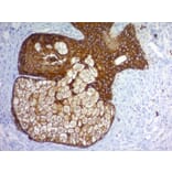 Immunohistochemistry - Anti-pan Cytokeratin Antibody [Cocktail PAN-CK] (A250892) - Antibodies.com