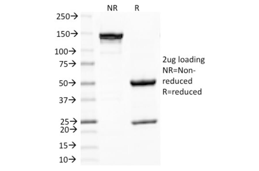 SDS-PAGE - Anti-PNL2 Antibody [PNL2] (A250893) - Antibodies.com