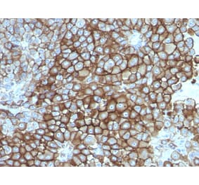 Immunohistochemistry - Anti-Melanoma Associated Antigen KBA.62 Antibody [KBA.62] (A250893) - Antibodies.com