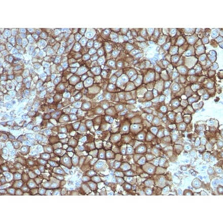 Immunohistochemistry - Anti-Melanoma Associated Antigen KBA.62 Antibody [KBA.62] (A250893) - Antibodies.com