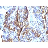 Immunohistochemistry - Anti-Melanoma Associated Antigen KBA.62 Antibody [KBA.62] (A250894) - Antibodies.com