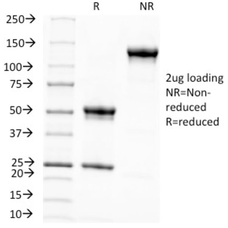 SDS-PAGE - Anti-Melanoma Associated Antigen KBA.62 Antibody [KBA.62] (A250894) - Antibodies.com