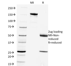 SDS-PAGE - Anti-Rabies Virus Antibody [Rab-50] (A250895) - Antibodies.com