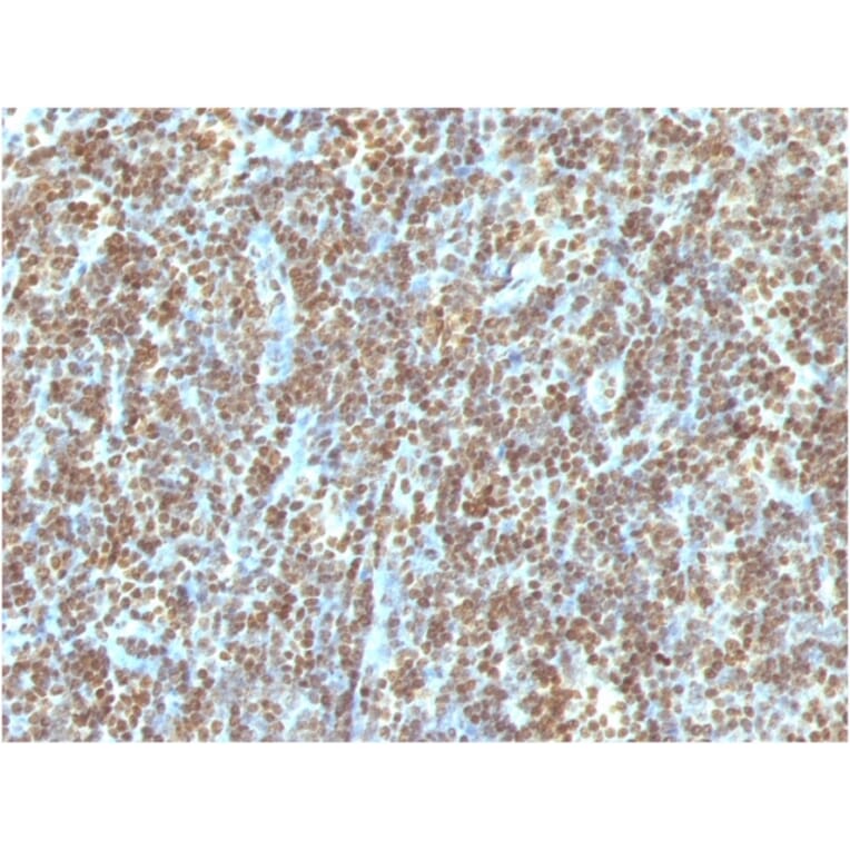 Immunohistochemistry - Anti-ds DNA Antibody [121-3] (A250897) - Antibodies.com