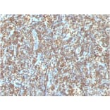 Immunohistochemistry - Anti-ds DNA Antibody [121-3] (A250897) - Antibodies.com