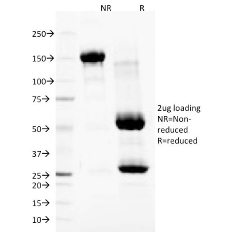 SDS-PAGE - Anti-Nuclear Membrane Antibody [NM97] (A250897) - Antibodies.com