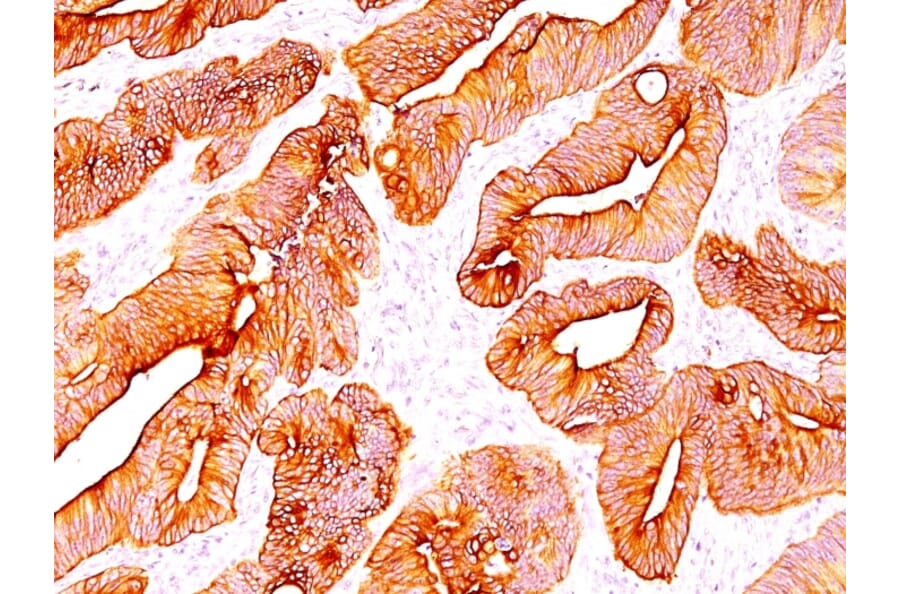 Immunohistochemistry - Anti-pan Cytokeratin Antibody [SPM583] (A250902) - Antibodies.com