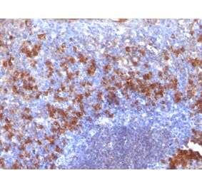 Immunohistochemistry - Anti-Biotin Antibody [SPM375] (A250903) - Antibodies.com