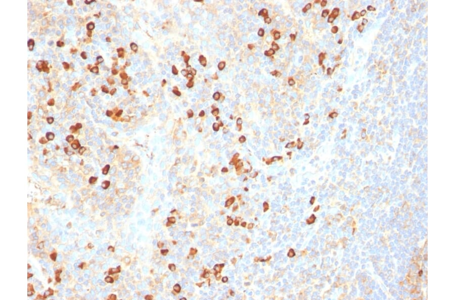 Immunohistochemistry - Anti-Plasma Cell Antibody [SPM310] (A250906) - Antibodies.com