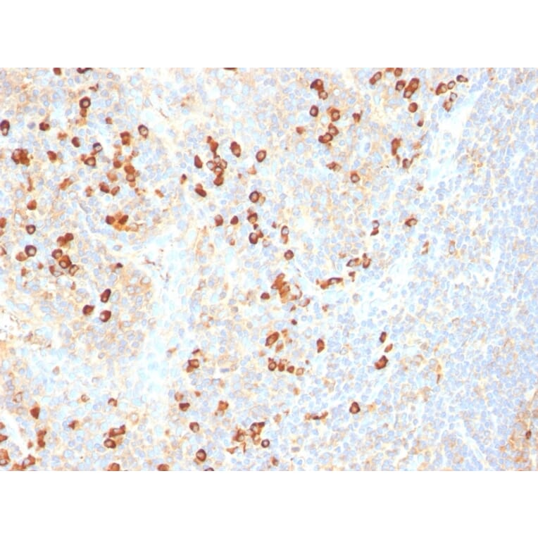 Immunohistochemistry - Anti-Plasma Cell Antibody [SPM310] (A250906) - Antibodies.com
