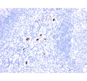 Immunohistochemistry - Anti-Macrophage + Granulocyte Antibody [SPM298] (A250908) - Antibodies.com