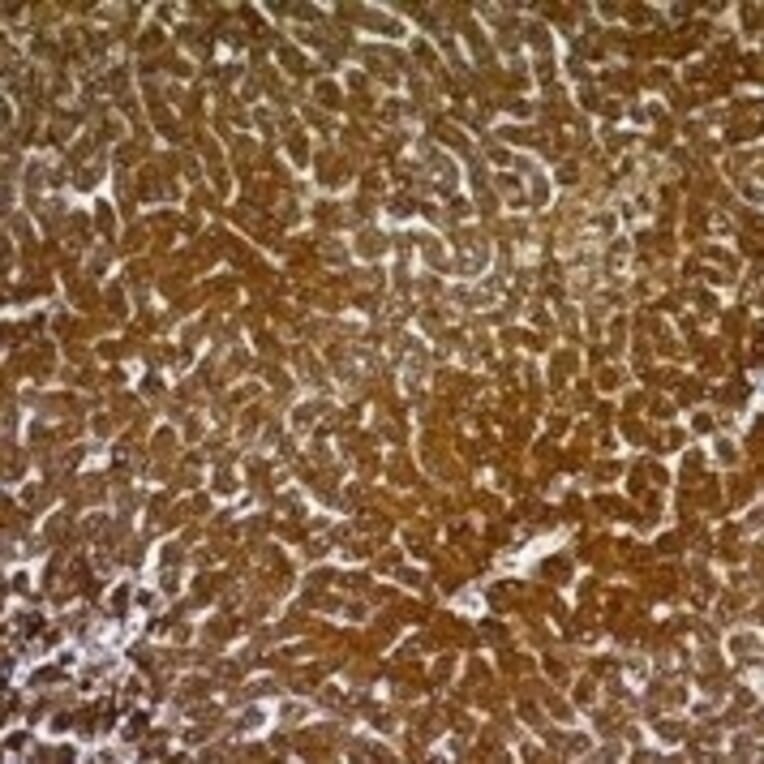 Immunohistochemistry - Anti-Hepatocyte Specific Antigen Antibody [SPM582] (A250909) - Antibodies.com