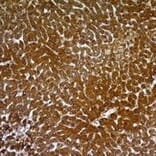 Immunohistochemistry - Anti-Hepatocyte Specific Antigen Antibody [SPM582] (A250909) - Antibodies.com
