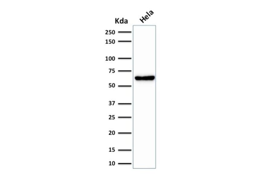 Western Blot - Anti-Mitochondria Antibody [SPM198] (A250911) - Antibodies.com