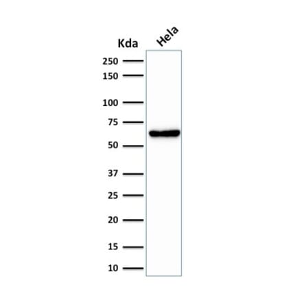 Western Blot - Anti-Mitochondria Antibody [SPM198] (A250911) - Antibodies.com