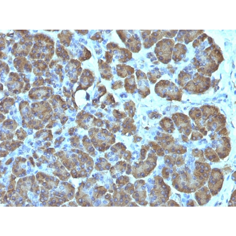 Immunohistochemistry - Anti-Mitochondria Antibody [SPM198] (A250911) - Antibodies.com