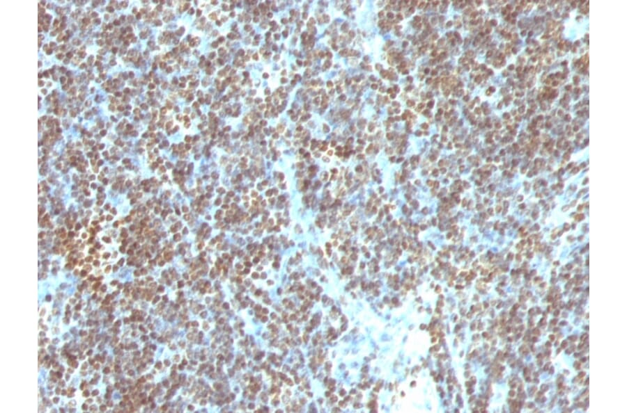Immunohistochemistry - Anti-ds DNA Antibody [SPM603] (A250911) - Antibodies.com
