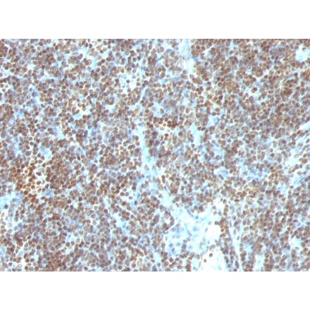 Immunohistochemistry - Anti-ds DNA Antibody [SPM603] (A250911) - Antibodies.com