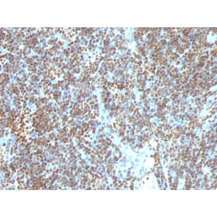 Immunohistochemistry - Anti-ds DNA Antibody [SPM603] (A250911) - Antibodies.com