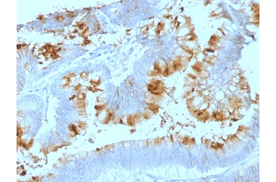 Immunohistochemistry - Anti-Blood Group Lewis a Antibody [SPM522] (A250912) - Antibodies.com