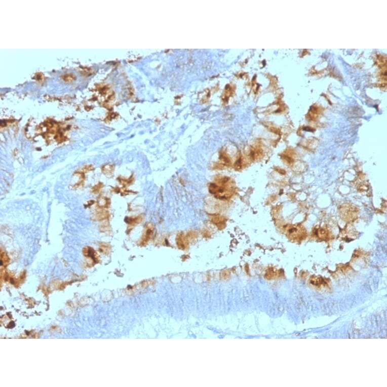 Immunohistochemistry - Anti-Blood Group Lewis a Antibody [SPM522] (A250912) - Antibodies.com