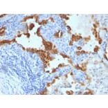 Immunohistochemistry - Anti-Cytokeratin 8 + 18 Antibody [B22.1/B23.1] (A250913) - Antibodies.com