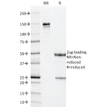 SDS-PAGE - Anti-Cytomegalovirus p65 Antibody [CMV101] (A250914) - Antibodies.com