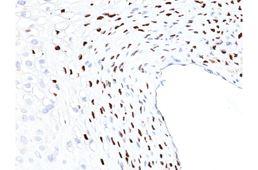 Immunohistochemistry - Anti-HPV16 L1 Antibody [HPV16L1/1058] (A250915) - Antibodies.com