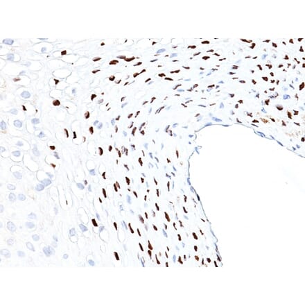 Immunohistochemistry - Anti-HPV16 L1 Antibody [HPV16L1/1058] (A250915) - Antibodies.com