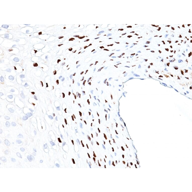 Immunohistochemistry - Anti-HPV16 L1 Antibody [HPV16L1/1058] (A250915) - Antibodies.com