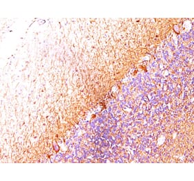 Immunohistochemistry - Anti-Neurofilament Heavy Polypeptide Antibody [RT-97 + NR-4] (A250917) - Antibodies.com