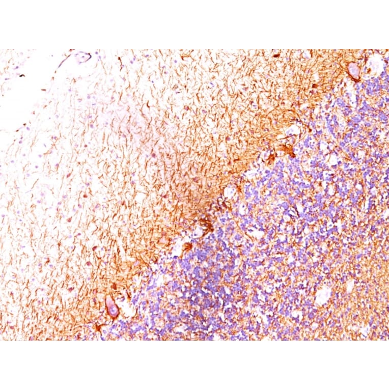 Immunohistochemistry - Anti-Neurofilament Heavy Polypeptide Antibody [RT-97 + NR-4] (A250917) - Antibodies.com
