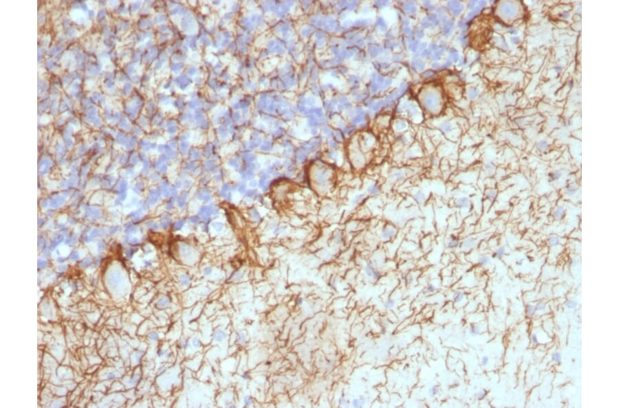 Immunohistochemistry - Anti-Neurofilament Heavy Polypeptide Antibody [RT-97 + NR-4] (A250917) - Antibodies.com