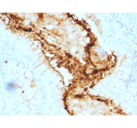 Immunohistochemistry - Anti-Blood Group Lewis y Antibody [A70-A/A9] (A250917) - Antibodies.com