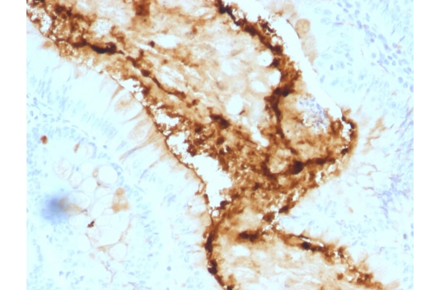 Immunohistochemistry - Anti-Blood Group Lewis y Antibody [A70-A/A9] (A250917) - Antibodies.com