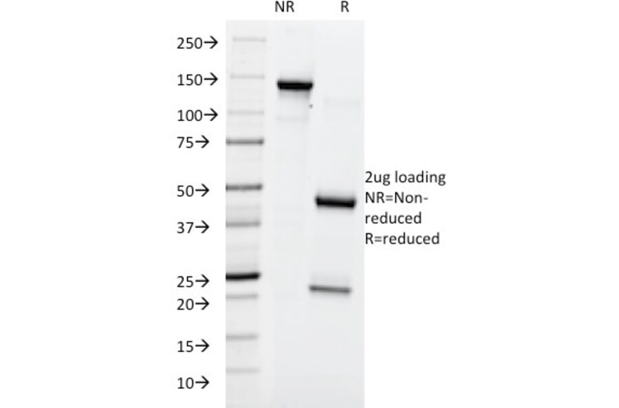 SDS-PAGE - Anti-Blood Group Lewis y Antibody [A70-A/A9] (A250918) - Antibodies.com