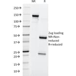 SDS-PAGE - Anti-Blood Group Lewis y Antibody [A70-A/A9] (A250918) - Antibodies.com