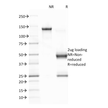SDS-PAGE - Anti-EBV Latent Membrane Protein 1 Antibody [CS1] (A250918) - Antibodies.com
